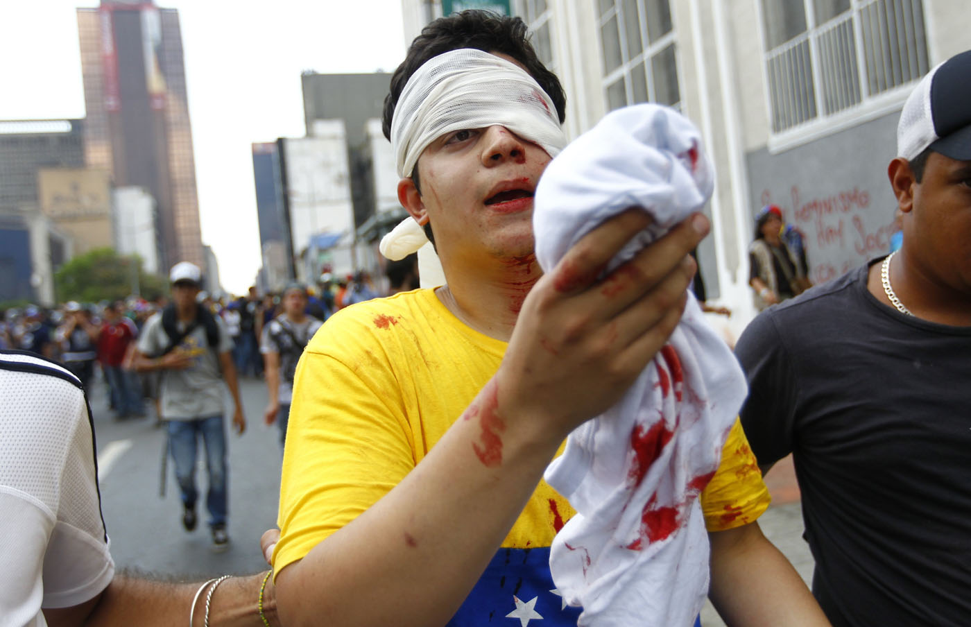 Estas son las fotos de la agresión a los estudiantes que recorren el mundo