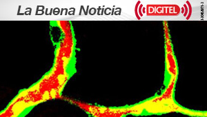 La inhibición de una proteína podría mejorar la aterosclerosis