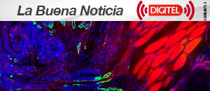 Identifican el punto débil de la metástasis