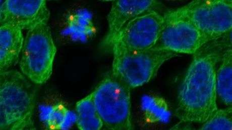 Descubren una reacción bioquímica clave en la reprogramación de las células