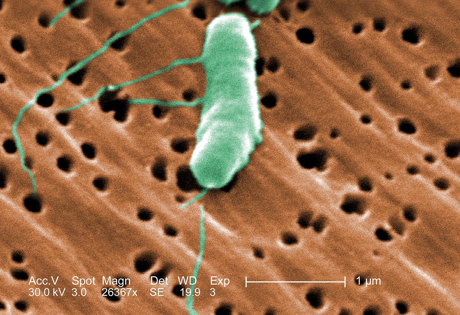 Dos muertos y once infectados en Florida por bacteria que devora la carne