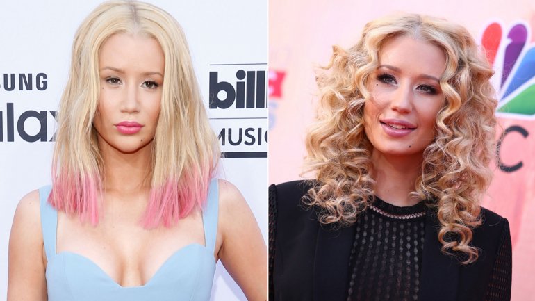 Iggy Azalea se sometió al bisturí y ahora está irreconocible