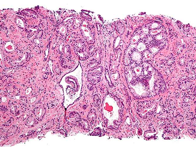 Científicos crean método para detectar cáncer con análisis de sangre