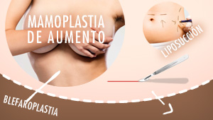 ¡Tabla de planchar forever! Más de 80 sueldos mínimos cuesta el aumento de glúteos en Venezuela (Infografía)