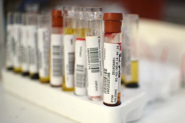 Blood samples from pregnant women are seen at the maternity of the Guatemalan Social Security Institute (IGSS) in Guatemala City on February 2, 2016. Guatemala increased the monitoring of pregnant women because of the risk of infection by Zika virus. World health officials mobilized with emergency response plans and funding pleas Tuesday as fears grow that the Zika virus, blamed for a surge in the number of brain-damaged babies, could spread globally and threaten the Summer Olympics. AFP PHOTO Johan ORDONEZ / AFP / JOHAN ORDONEZ