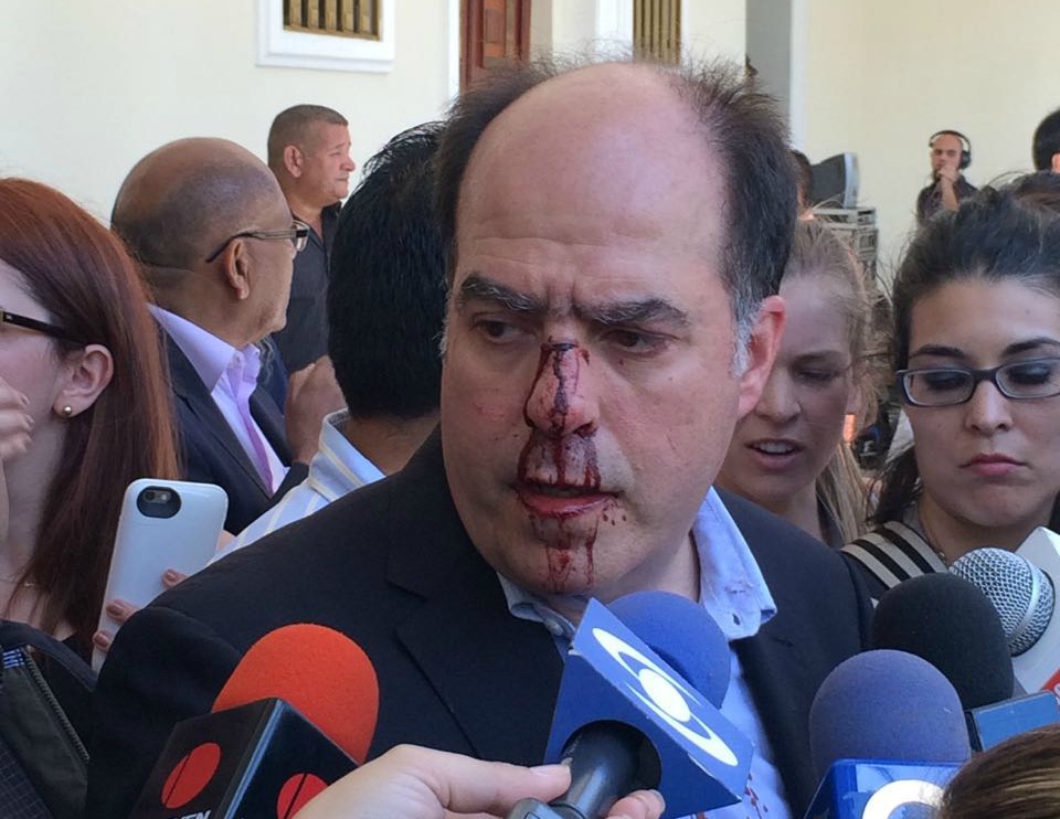 Imputado pero en libertad agresor que le dio una pela a Julio Borges