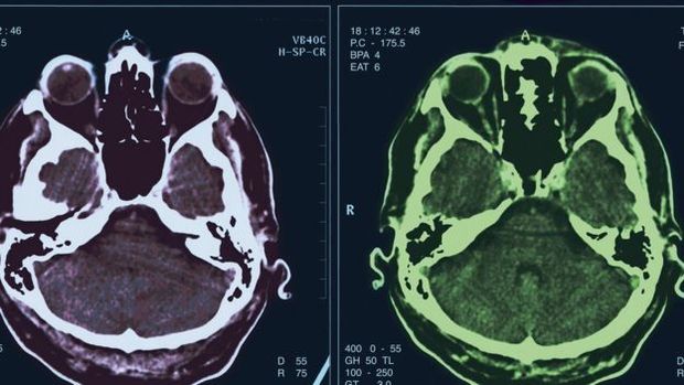 La simpatía puede estar relacionada con la forma del cerebro