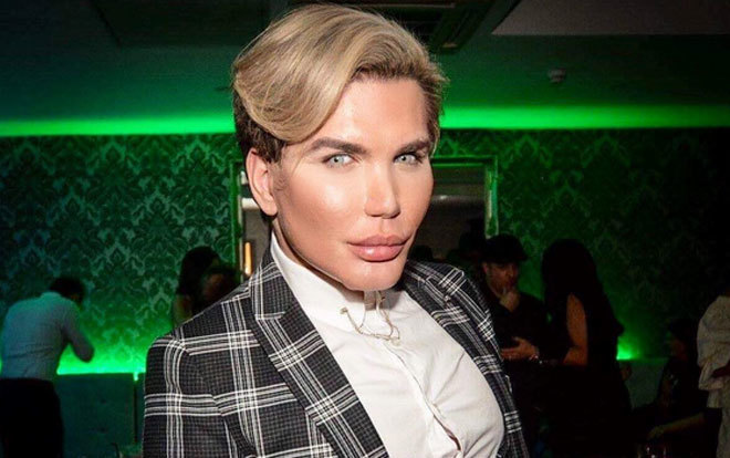 Rodrigo Alves, el “Ken Humano” se quemó la cara para lucir más joven