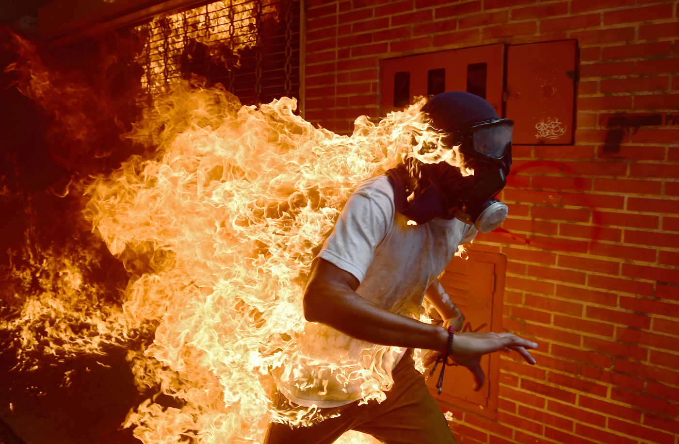 Dos manifestantes sufrieron quemaduras durante las protestas de este #3May (Fotos + Video)