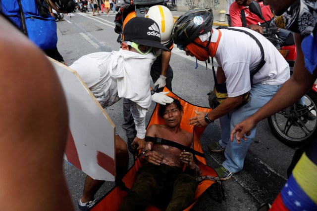 Reuters / joven quemado en las protestas de este #3May