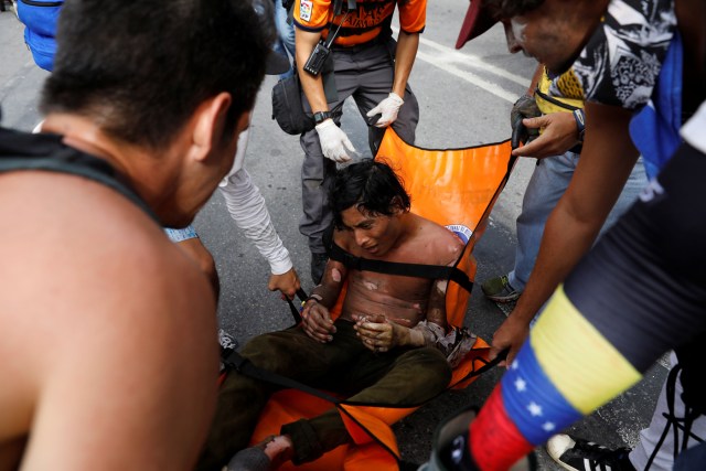 Reuters / joven quemado en las protestas de este #3May