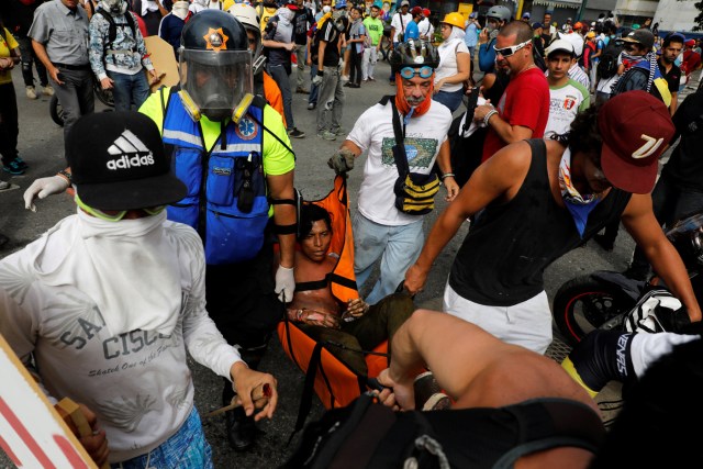 Reuters / joven quemado en las protestas de este #3May