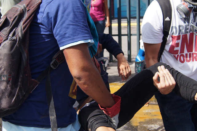 Reportan un afectado por inhalación de gases lacrimógenos en Las Mercedes. Foto: Gabriela Gómez / lapatilla.1eye.us