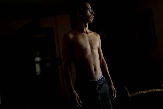 Manuel Melo, un estudiante de 21 años que resultó herido durante una protesta contra el Gobierno de Nicolás Maduro en Venezuela, posa para una fotografía en su casa en Caracas (Foto Reuters)