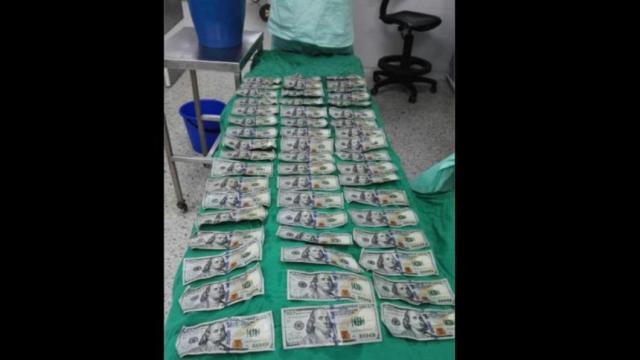 Los billetes que le sustrajeron a la mujer de su zona abdominal. Tomada de Internet/Hospital Universitario de Santander (El Heraldo)