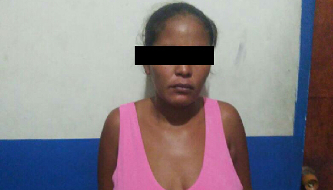 Madre le quemó boca a su hijo de 8 años por comerse unos frijoles en Yaracuy