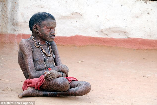 El hombre culebra cambia de piel cada 10 días (FOTOS)