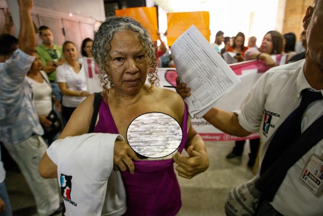 Elizabeth Salazar (c), paciente de cáncer de 64 años, muestra su seno durante una protesta de pacientes con enfermedades crónicas hoy, martes 5 de junio de 2018, en Caracas (Venezuela). Decenas de pacientes con enfermedades crónicas protagonizaron hoy una nueva protesta ante el Ministerio de Salud de Venezuela para exigir los medicamentos, tratamientos y materiales médicos que escasean en el país suramericano, al tiempo que alertaron sobre las miles de personas que están en riesgo. EFE/Edwinge Montilva