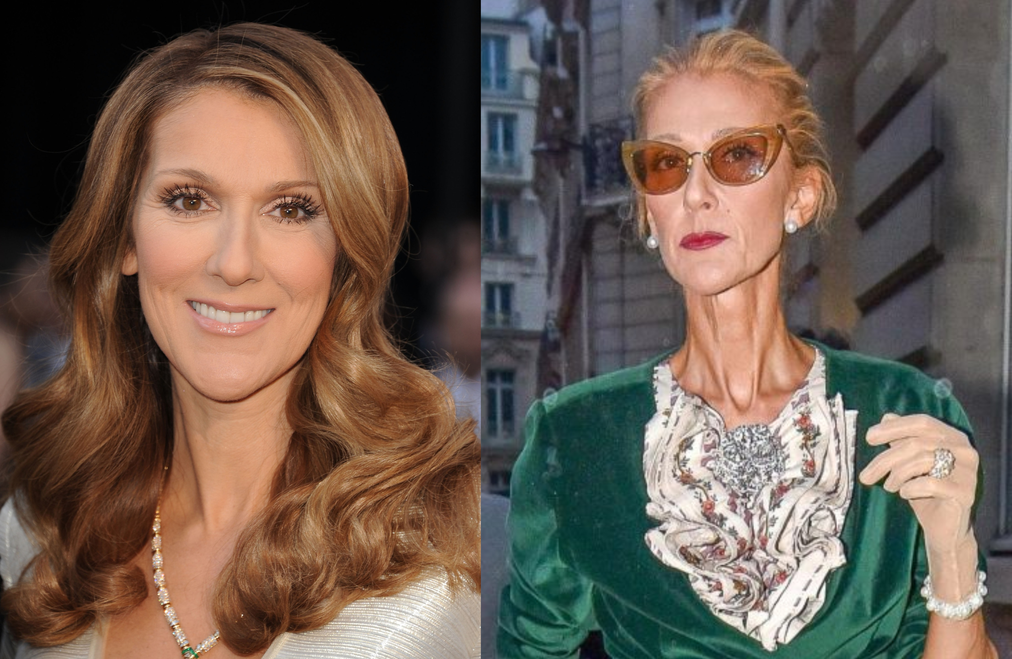 Céline Dion explicó la razón de su “extrema” delgadez