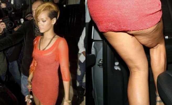 A Rihanna le cuelga el mondonguero: La TERRIBLE FOTO de nuestra chocomamasita en su peor momento