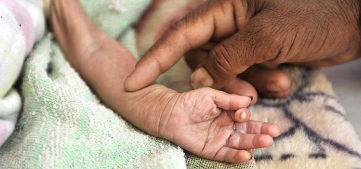 Uno de cada tres niños sufre desnutrición o sobrepeso en el mundo, según Unicef