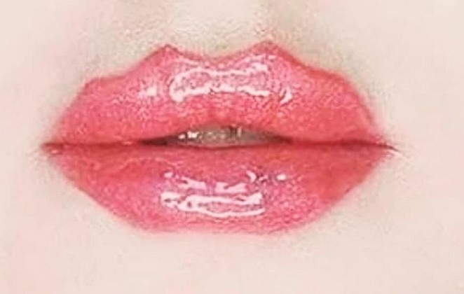 “Labios del diablo”: Los riesgos y las dudas alrededor de la nueva tendencia de belleza