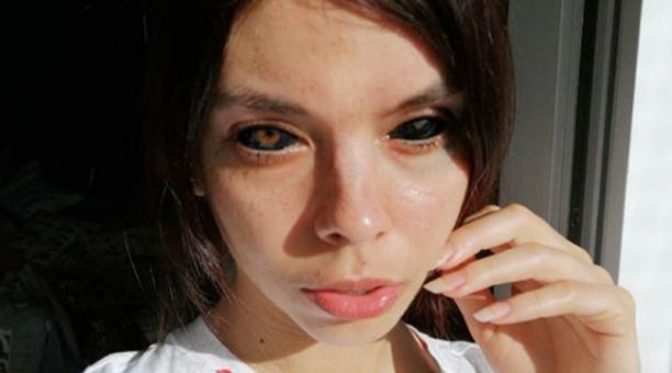 Por tatuarse el blanco de los ojos: Modelo de 25 años quedó ciega