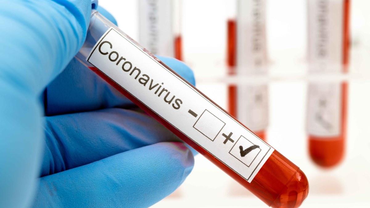 Niños migrantes bajo custodia de EEUU dan positivo por coronavirus