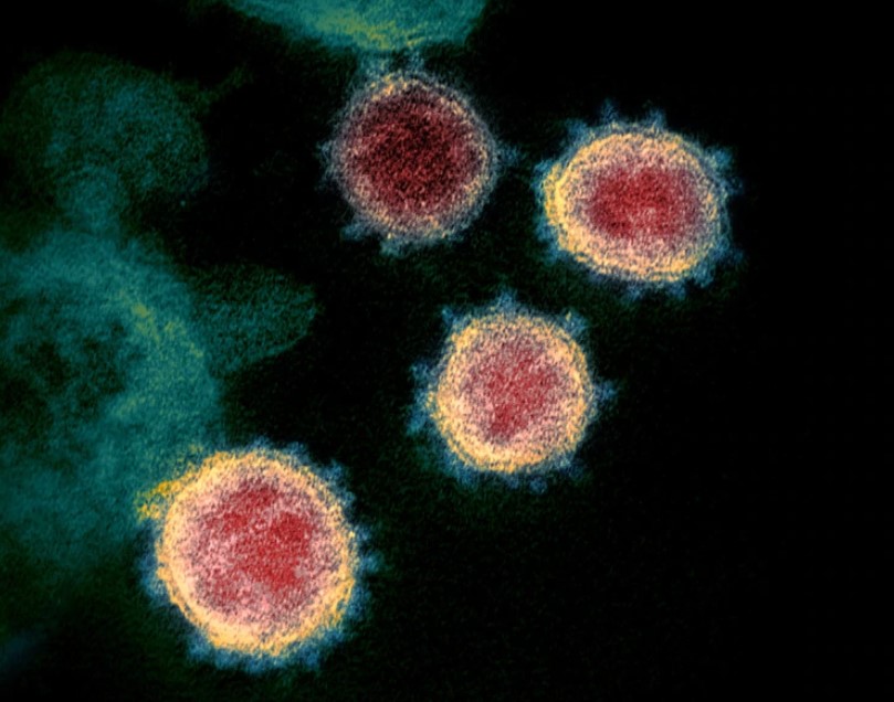 A qué temperatura y nivel los rayos solares y la humedad son mortales para el coronavirus en superficies y en aire