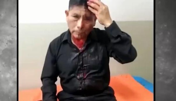 Sicarios hieren de gravedad a funcionario peruano por resistirse a sus mandatos (Foto)