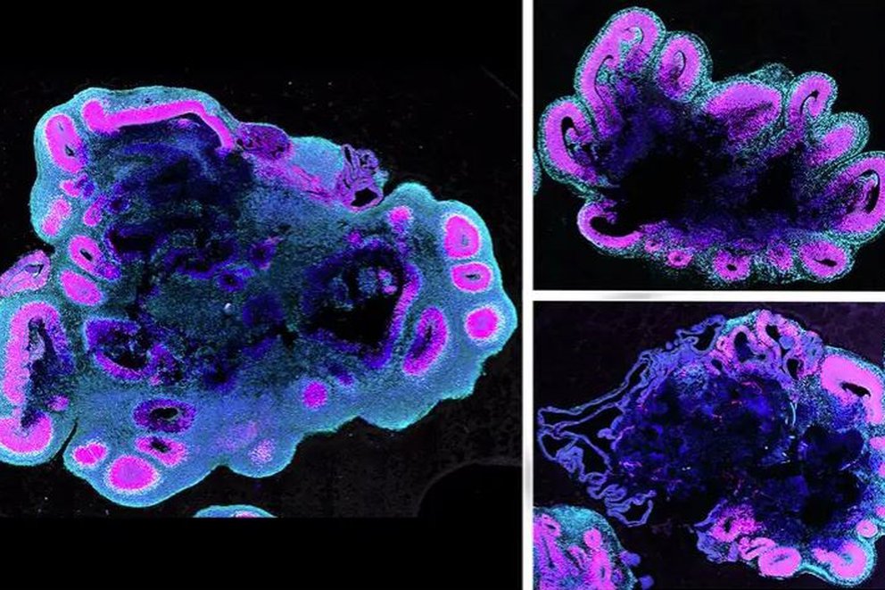 Científicos habrían encontrado la clave que explica por qué los cerebros humanos son tan grandes