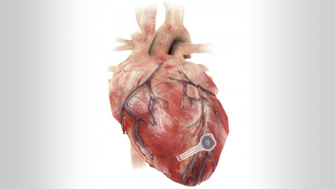 Investigadores en EEUU desarrollaron el primer marcapasos “transitorio” de la historia