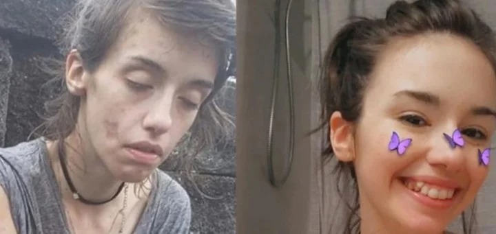 La dura imagen de una joven adicta a las drogas y su gran mensaje