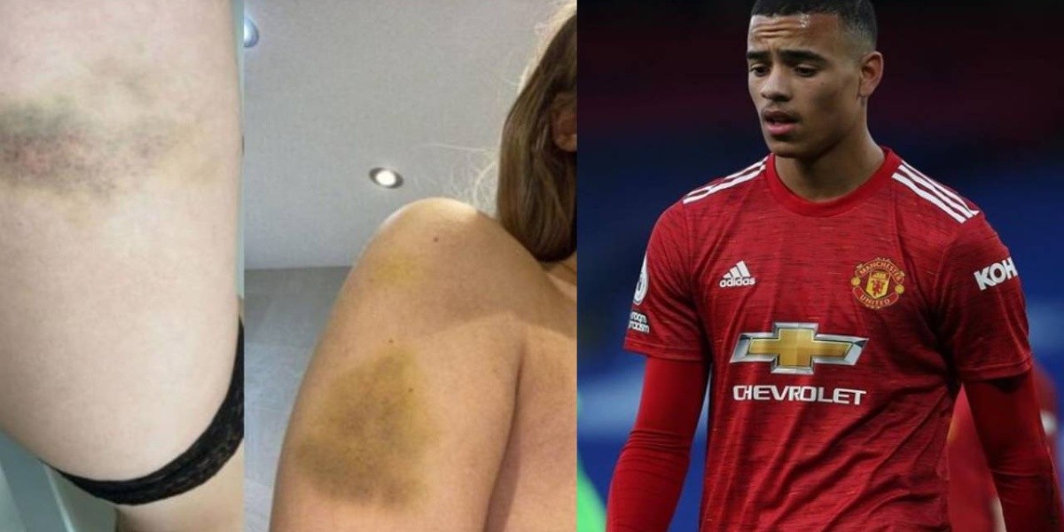 Mason Greenwood, acusado formalmente por intento de violación y lesiones