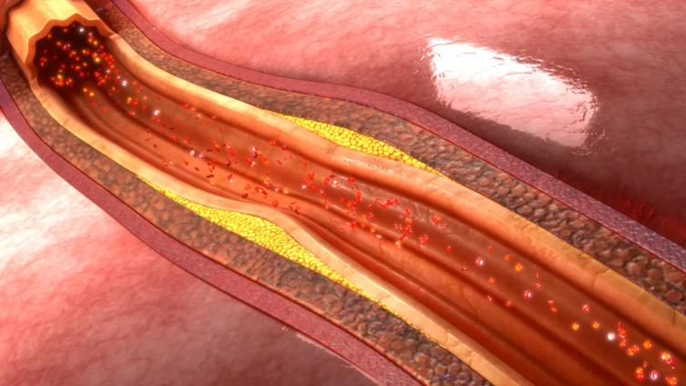 ¿Cuál es el alimento clave para reducir el colesterol? Expertos de Harvard responden