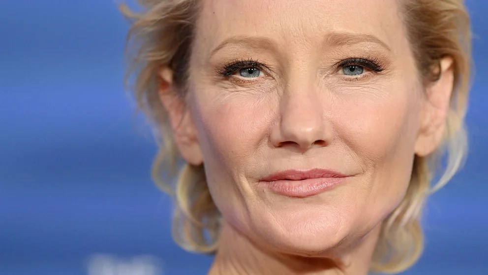 Los análisis de Anne Heche revelaron que tenía drogas en su sangre antes del accidente que la dejó en coma