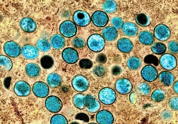 El virus de la viruela del mono está mutando: cuál es el pronóstico para el mundo