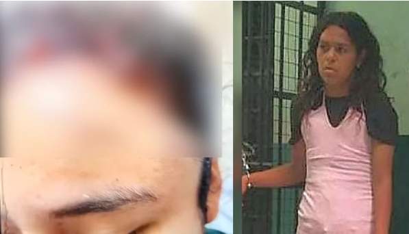 Venezolana desfiguró la cara de una mesera y mordió la oreja de otra persona porque le sirvieron poca comida en Perú