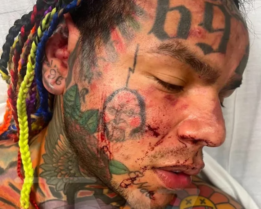 El rapero Tekashi 6ix9ine fue hospitalizado de emergencia tras recibir una brutal golpiza en un gimnasio de Florida