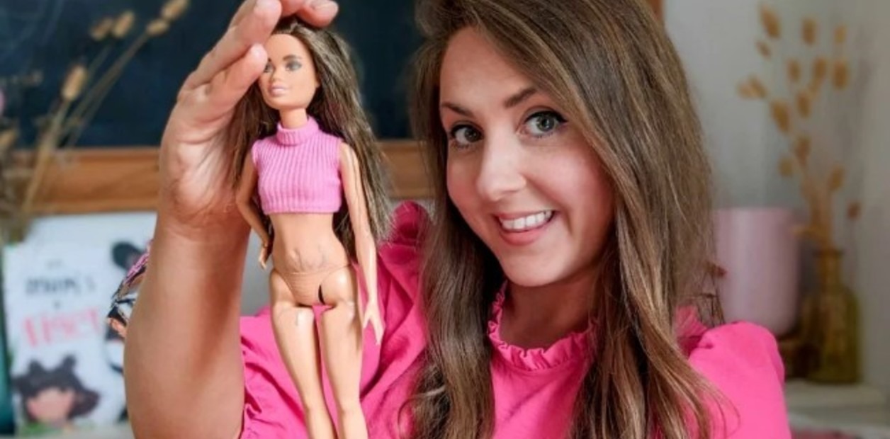 VIRAL: Mujer diseñó una muñeca Barbie con estrías para su hija (FOTOS)