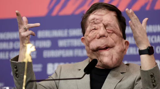 La inspiradora historia de Adam Pearson: el actor con neurofibromatosis que triunfa en Hollywood