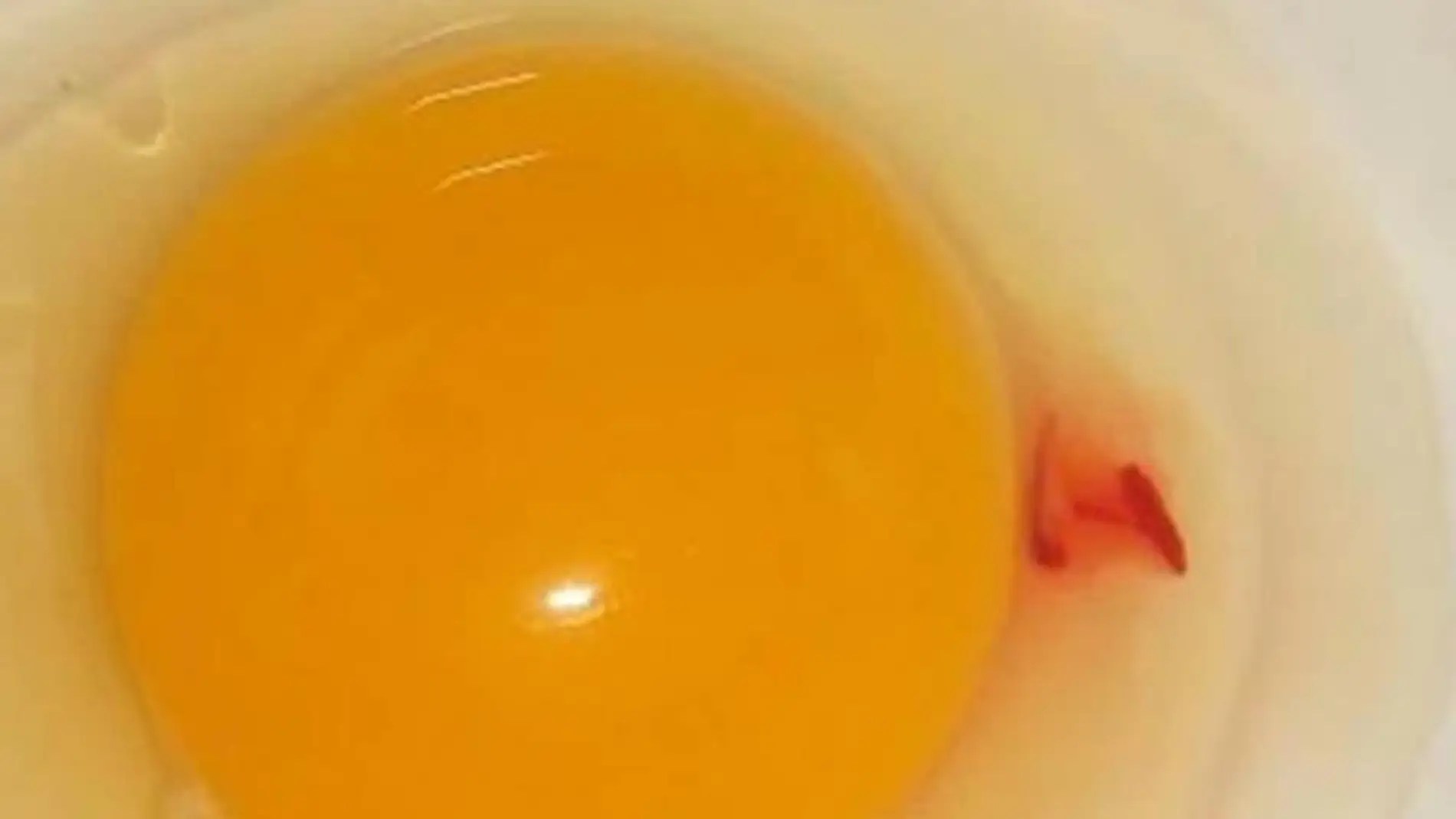 Qué son las manchas rojas de los huevos: esto dicen los especialistas