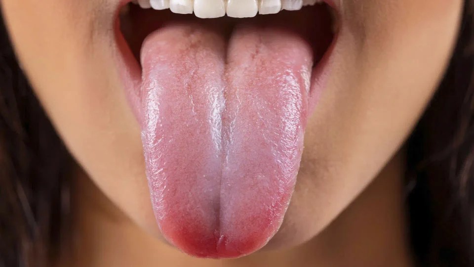 La lengua como indicador de salud: ¿qué dice este pequeño órgano sobre el bienestar humano?