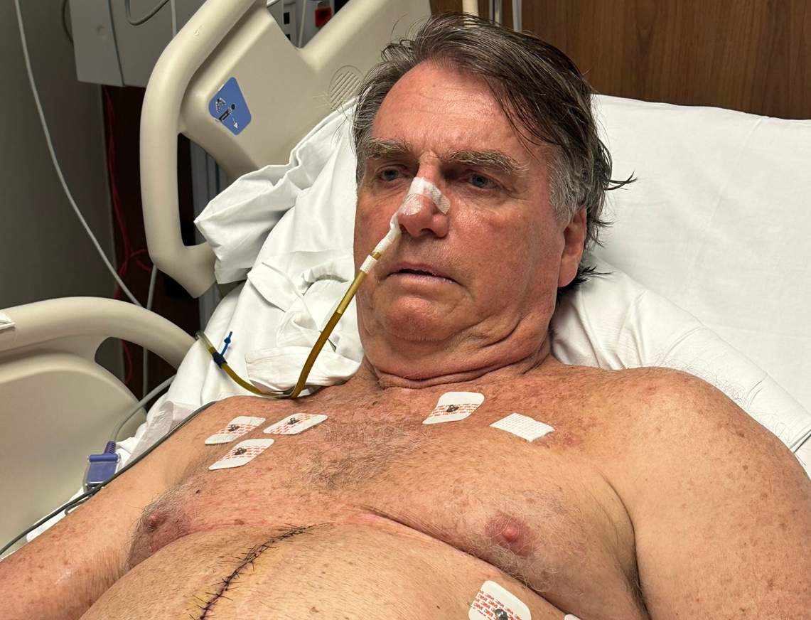 Bolsonaro sigue sin previsión de alta una semana después de ser operado del intestino